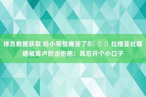 球员数据获取 给小哥整痛苦了😅拉维亚社媒晒被库卢肘击伤疤：耳后开个小口子